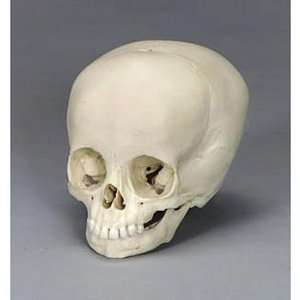 Bones Clones(r) Human Child Skull, 2 1/2 year old  