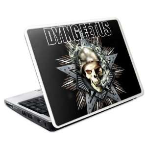   Netbook Small  8.4 x 5.5  Dying Fetus  Parasites Of Catastrophe Skin