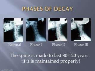 CHIROPRACTIC GROUP REPORT OF FINDINGS   SEE300AWEEK   2 CDs w/ AUDIO 