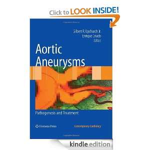 Aortic Aneurysms Pathogenesis and Treatment (Contemporary Cardiology 