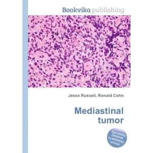  Mediastinal tumor Ronald Cohn Jesse Russell Books