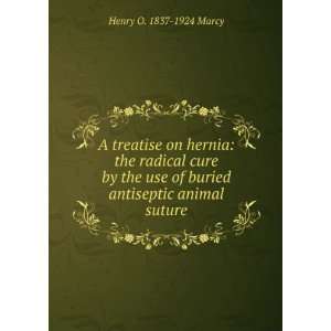   of buried antiseptic animal suture Henry O. 1837 1924 Marcy Books
