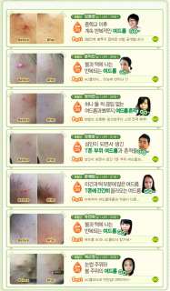   _clinic_toner/etudehouse_etude_house_ac_clinic_toner_description2