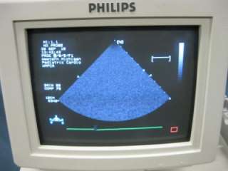 HP Philips Sonos 5500 Ultrasound Cardiac Echo FREE SHIP  