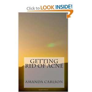  Getting rid of acne (9781451507461) Amanda Carlson Books