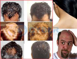 laser treatment power grow comb kit stop hair loss hot